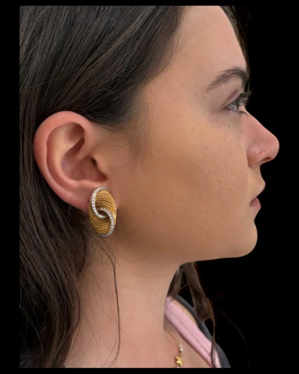 Boucles d'oreilles à clip en or et diamants Harpo's Italia