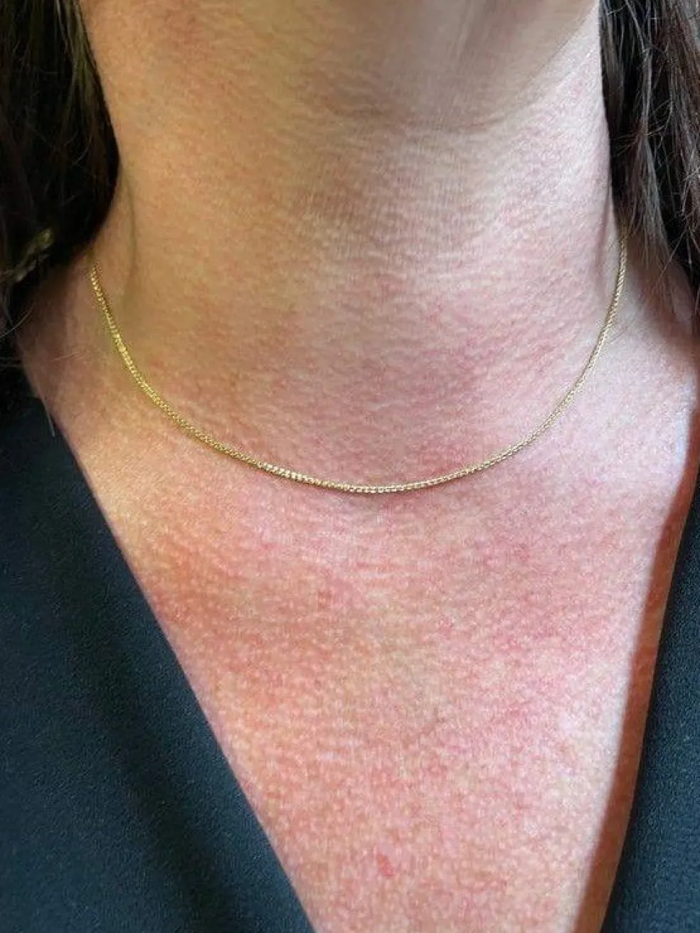 CHAINE MAILLE PALMIER